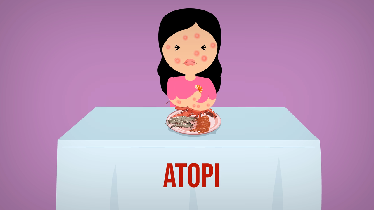 Kenapa Kita Bisa Alergi? *Explained with Animation!