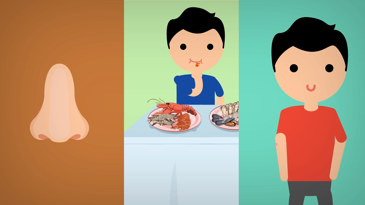 Kenapa Kita Bisa Alergi? *Explained with Animation!