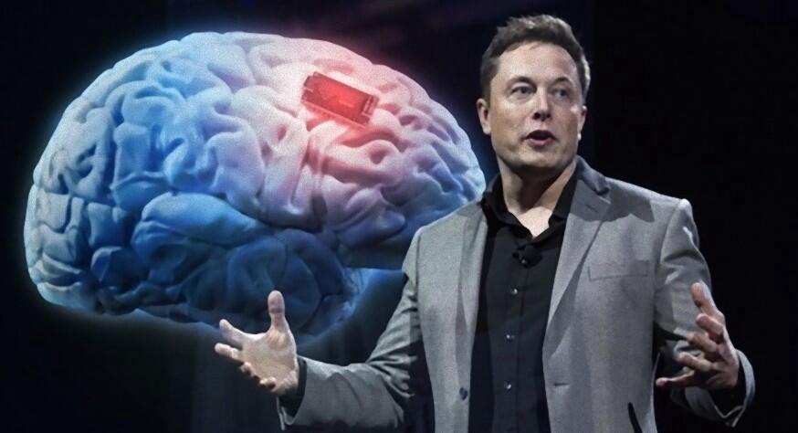 Apa itu Neuralink dan Bagaimana Cara Kerjanya ?