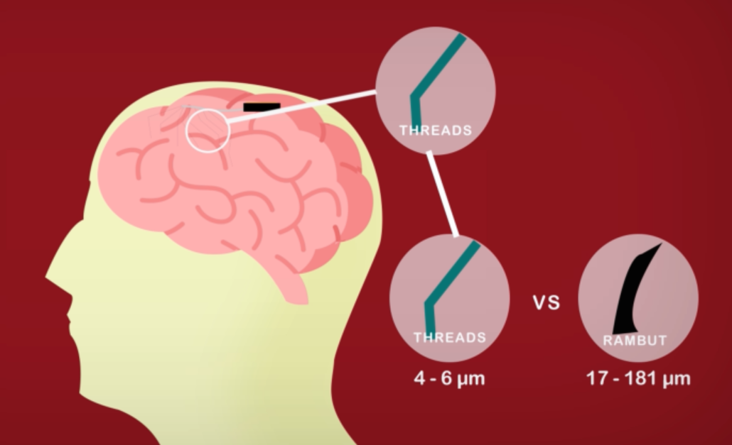 Apa Itu Neuralink Dan Bagaimana Cara Kerjanya ? | KASKUS