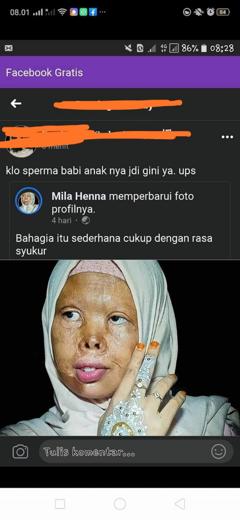 Dibully Karena Kekurangan Fisik, Wanita Ini Tetap Bersyukur Dan Percaya Diri