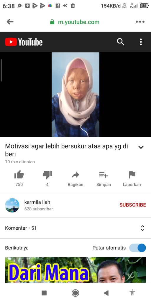 Dibully Karena Kekurangan Fisik, Wanita Ini Tetap Bersyukur Dan Percaya Diri