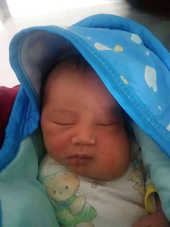 Butuh Bantuan Donasi Buat Anak Kena Tumor Pipi Sejak Lahir
