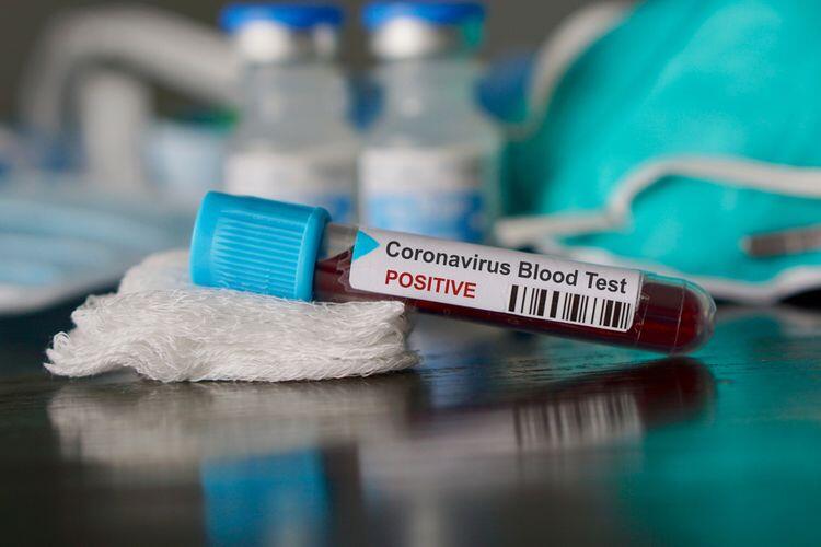 5 Studi Terbaru Terkait Virus Corona