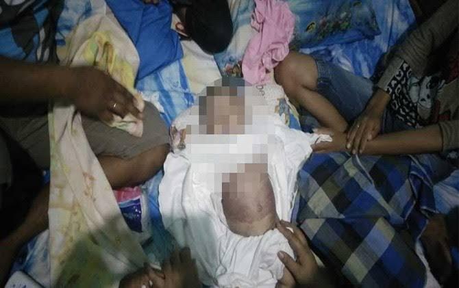 Bayi 6 Bulan Tewas Diduga Akibat Gas Air Mata Polisi