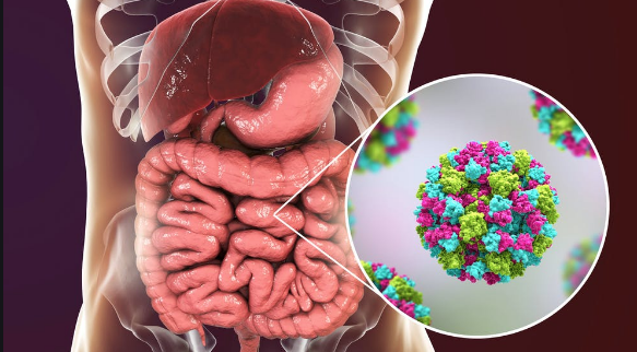 Norovirus Sudah Ada di RI, Ini Gejala dan Cara Mencegahnya