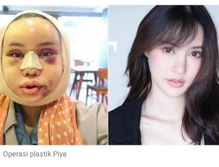 Cantik Itu Ada Empat, Diantaranya Kamu Yang Mana Ya?