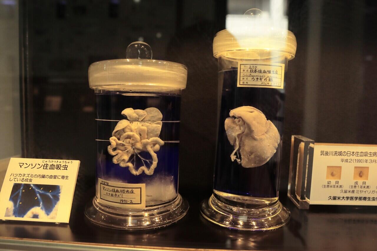 Melihat sampel asli parasit di museum parasit Jepang | Meguro Parasitological Museum