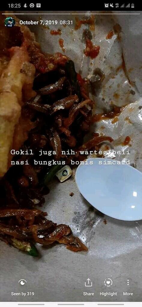 Gan, Selapar Apapun Perut Jangan Langsung Embat Aja Makanan, Atau Kayak Gini Jadinya!