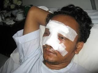 kaskus-image