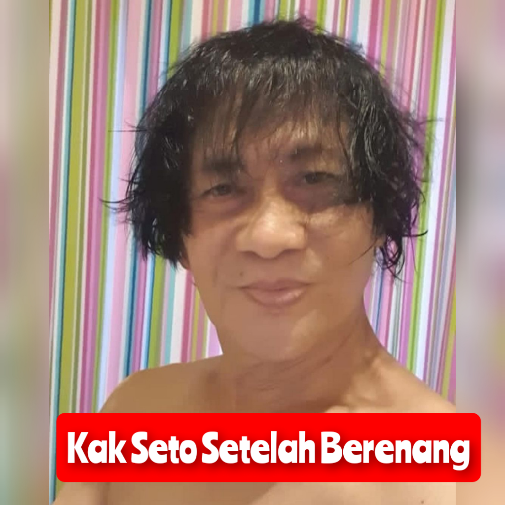 Akhirnya Terjawab, Begini Rambut Asli Kak Seto Mulyadi