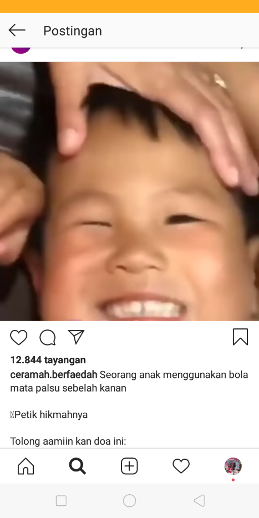 Melihat Caranya Memakai Mata Palsu, Sudahkah Kita Bersyukur?