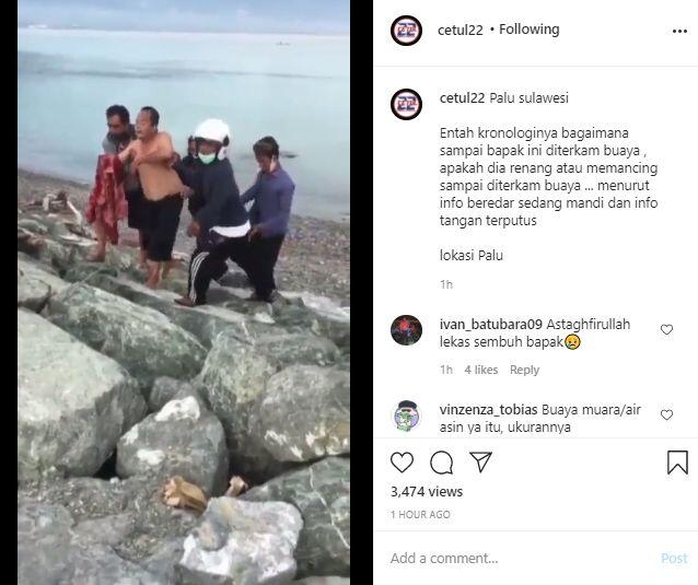 Diterkam Buaya saat Berenang di Laut, Tangan Ateng Nyaris Putus