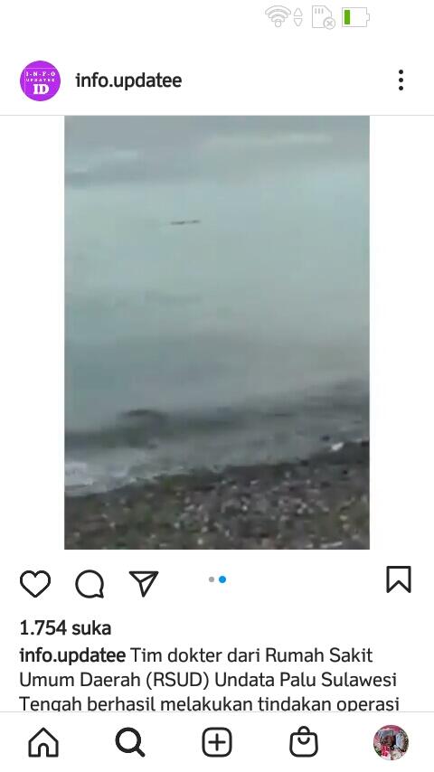 Ganas! Tangan Seorang Pria Ini Nyaris Putus Karena Serangan Buaya