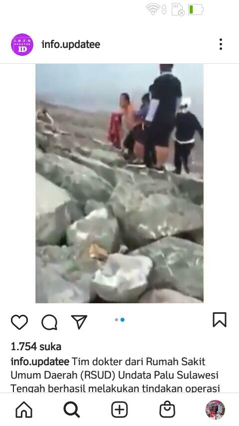 Ganas! Tangan Seorang Pria Ini Nyaris Putus Karena Serangan Buaya