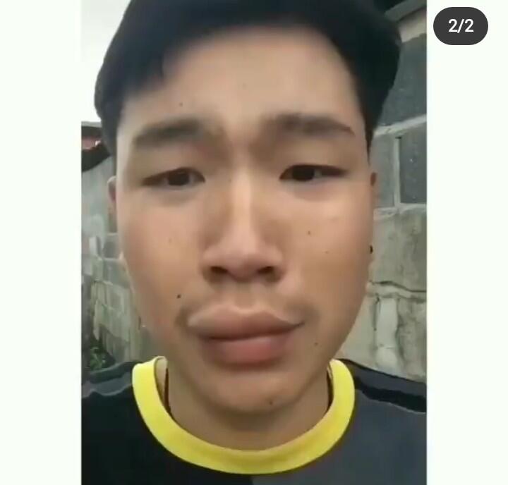 Makan Madu Langsung Dari Sarangnya, Seketika Bibir Pria Ini Berubah