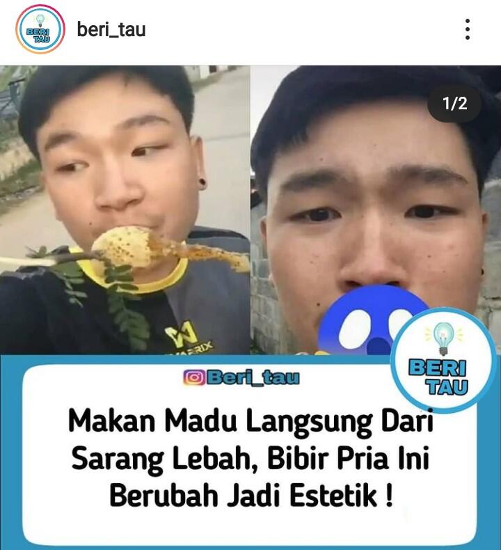 Makan Madu Langsung Dari Sarangnya, Seketika Bibir Pria Ini Berubah