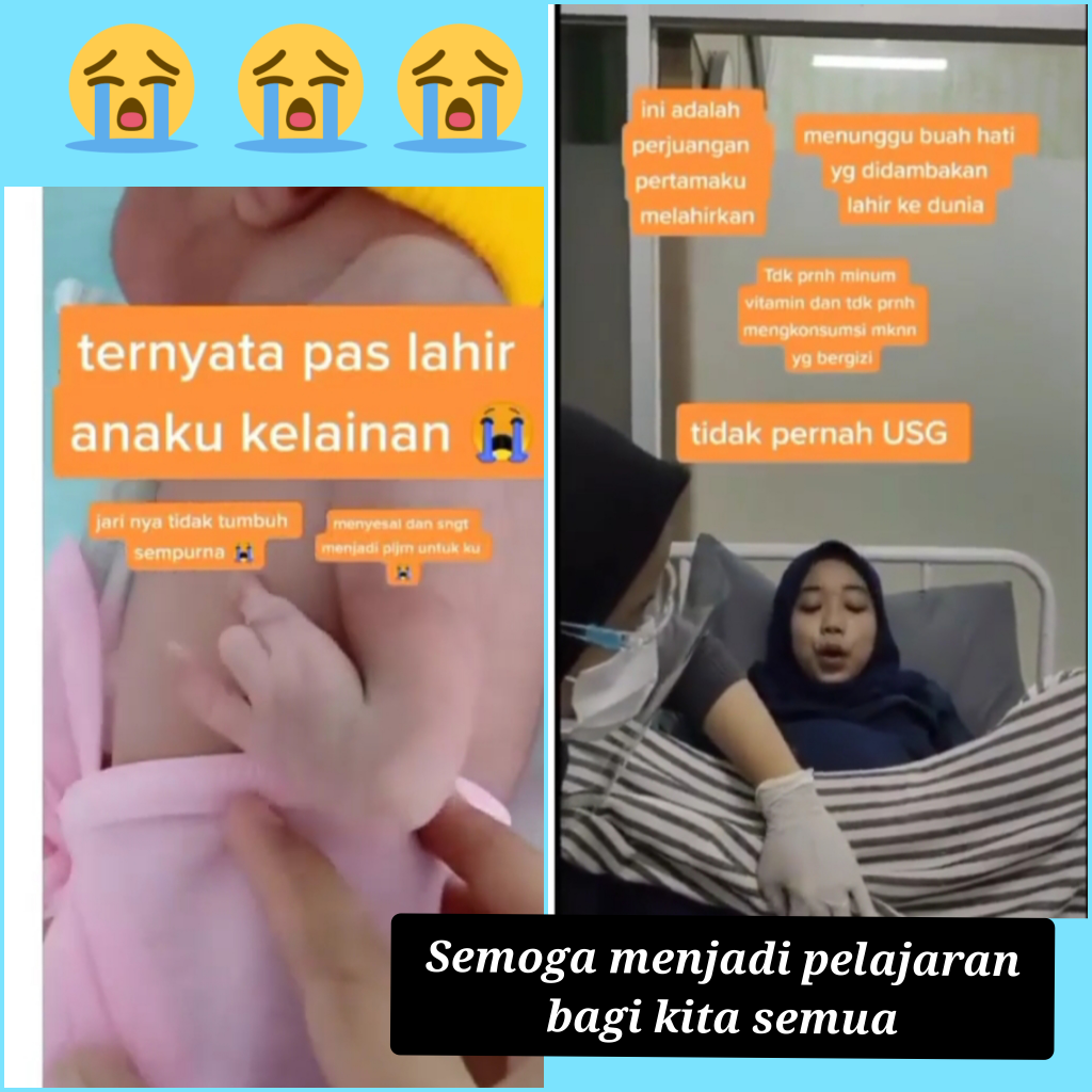 Kisah Seorang Ibu Melahirkan Tapi Bayinya