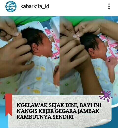 Bayi Ini Histeris Lantaran Menarik Rambutnya Sendiri! Net: Bakat Lawaknya Udah Muncul