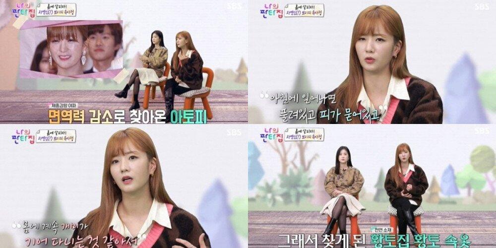 Jalani Diet Ekstrem, Bomi Apink Alami Ruam Kulit Parah hingga Lakukan Ini Tiap Tidur