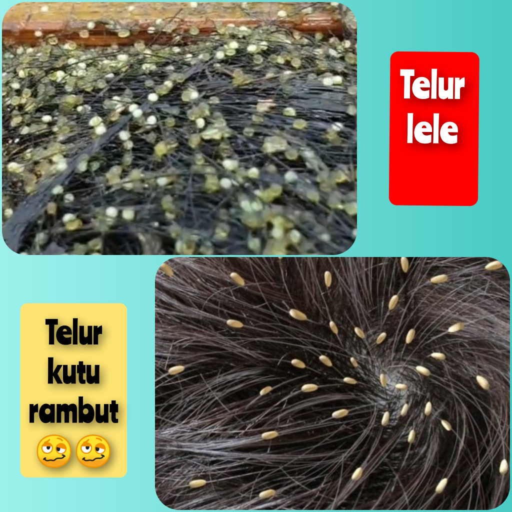 Bikin Geli.. Ternyata Begini Penampakan Telur Lele.. Mirip Kutu Di Rambut