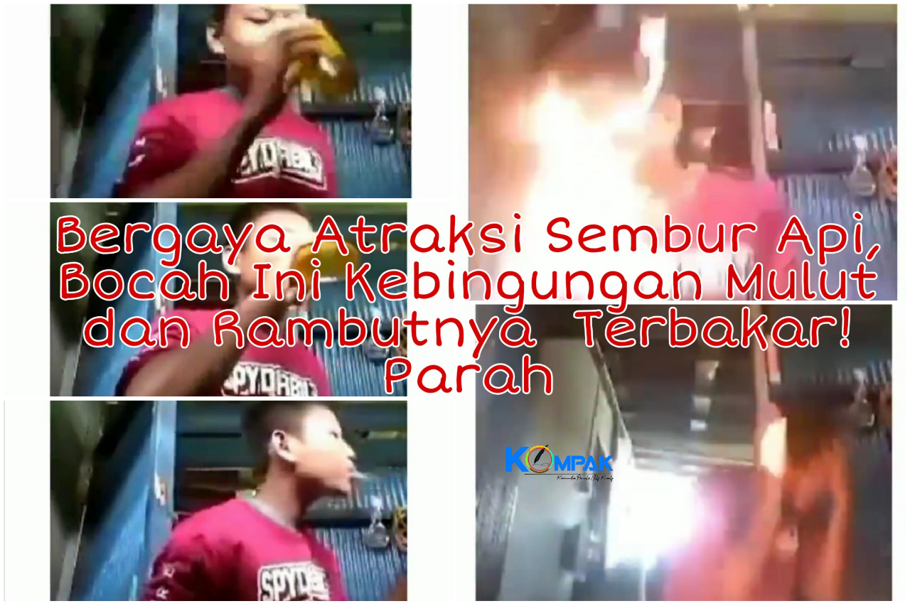 Lakukan Atraksi Sembur Api, Bocah Ini Bingung karena Mulut dan Rambutnya Terbakar! 