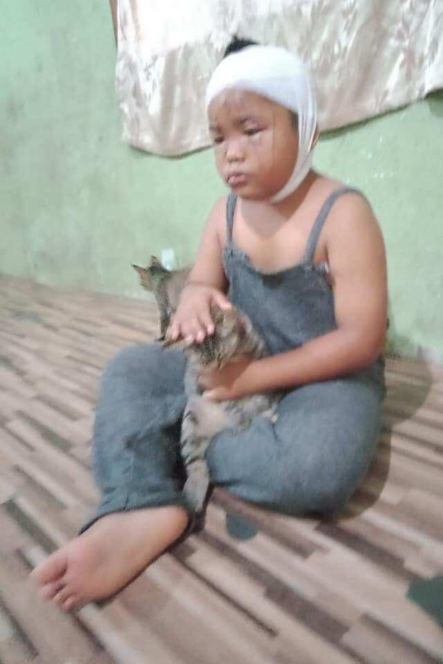 Viral ! Wajahnya 'DICAKAR' Habis Oleh Kucing, Cinta Bocah Ini Tak Luntur !