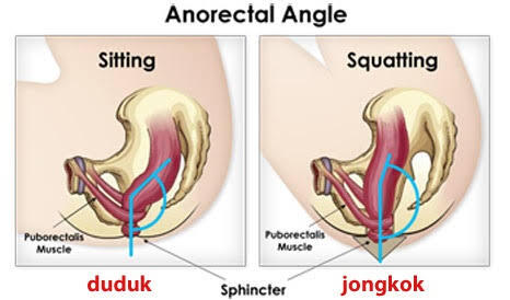 Kamu Kalau Kencing Berdiri Atau Jongkok?