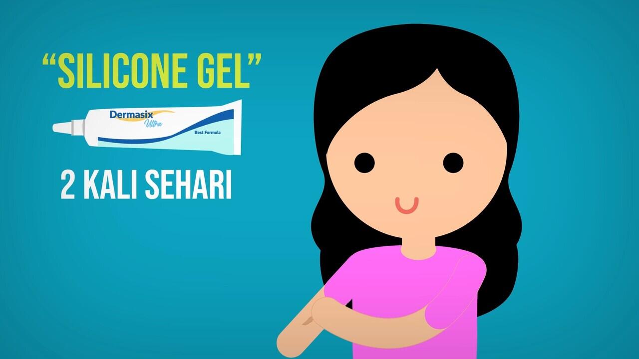CARA MENGHILANGKAN KELOID