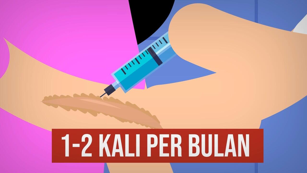 CARA MENGHILANGKAN KELOID
