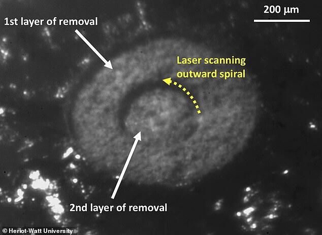 Luar Biasa Alat Penyelamat Manusia, Laser Ini Dapat Mengangkat Kanker Secara Akurat, 