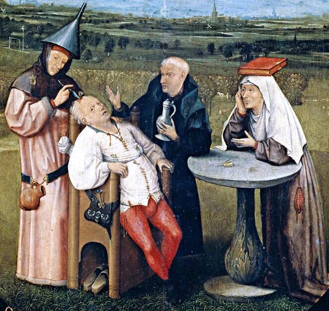 Trepanation! Operasi Bedah Ekstrem Yang Mengharuskan Kepala Manusia Dilubangi!