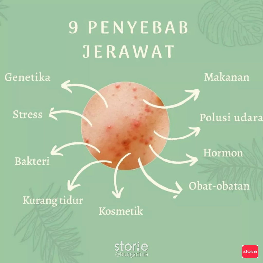 Ini dia nih biang keroknya sist !