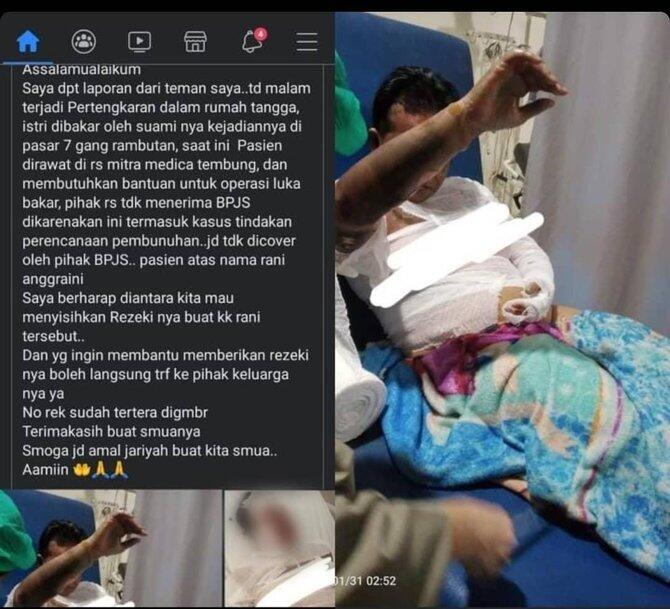 Terungkap, Ini Motif Suami Bakar Istri di Deli Serdang