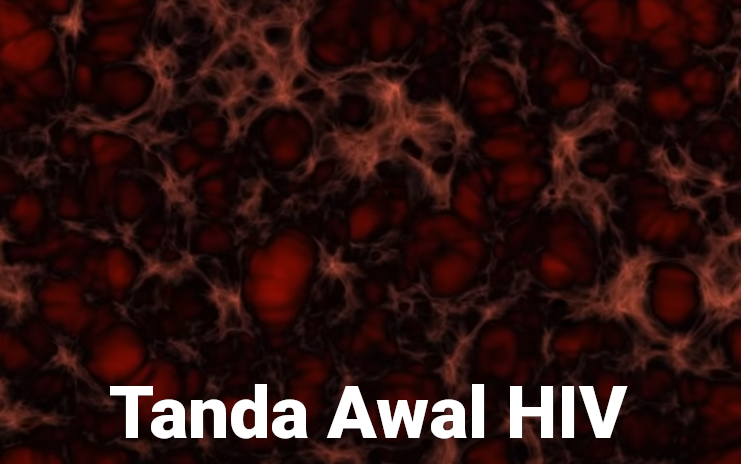 Tanda dan Gejala Awal Terinfeksi HIV Yang Tidak Umum Terjadi
