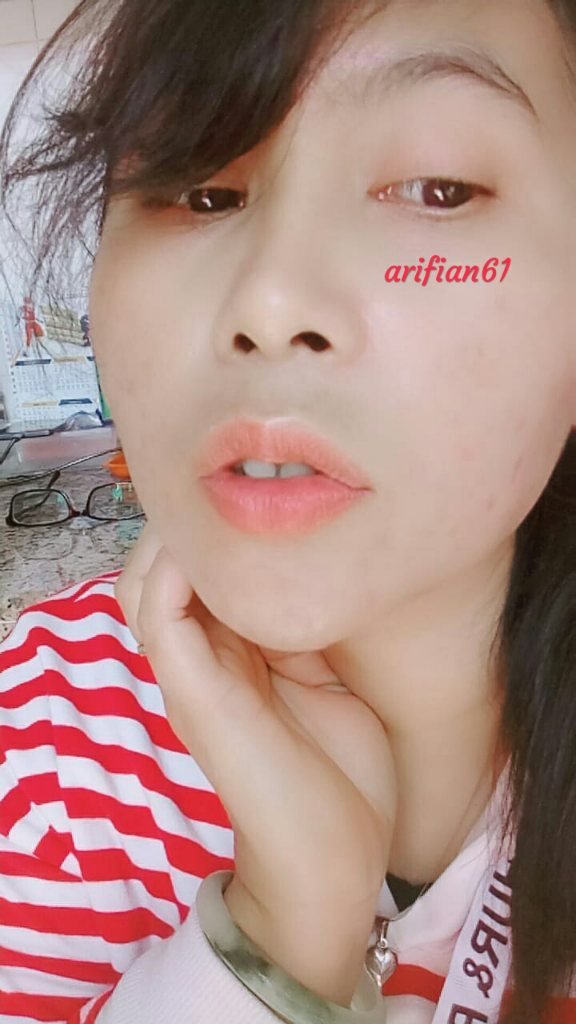 Pakai Farm Stay Aloe Vera Gel Jerawat Bandel Lari Kocar-Kacir, Wajah Sehat Glowing