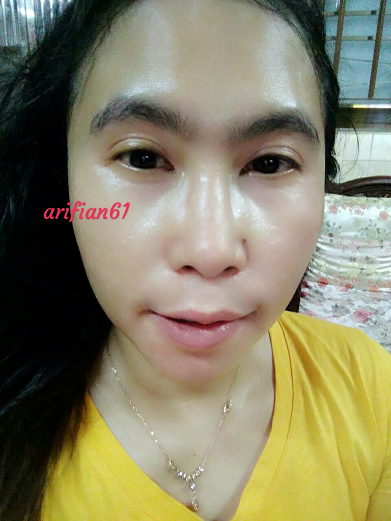 Pakai Farm Stay Aloe Vera Gel Jerawat Bandel Lari Kocar-Kacir, Wajah Sehat Glowing
