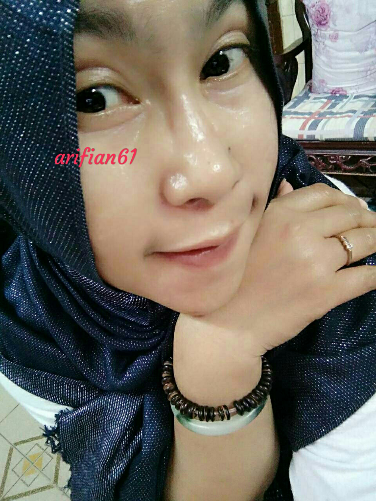 Pakai Farm Stay Aloe Vera Gel Jerawat Bandel Lari Kocar-Kacir, Wajah Sehat Glowing