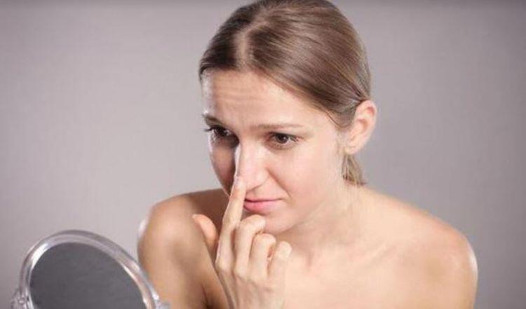 JANGAN DILAKUKAN! 5 Hal Ini Bisa Membuat Komedo Kamu SEMAKIN PARAH!!!