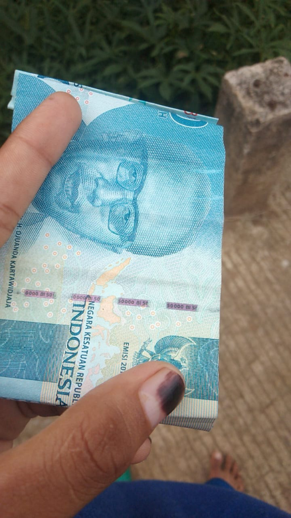 Mata Panda?! Ini Solusinya