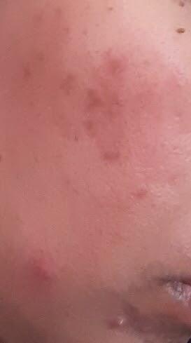 HABBATUSAUDA EKSTRA PROPOLIS TRIGONA MENGUBAH WAJAHMU JADI GLOWING