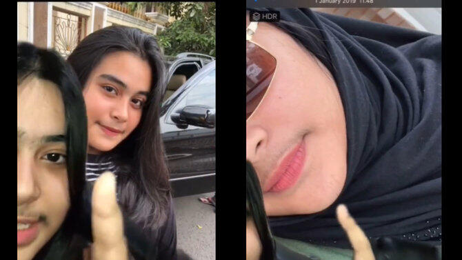 Apakah Bisa Wanita Berkumis, Kelainan Atau Punya Nafsu Tinggi?