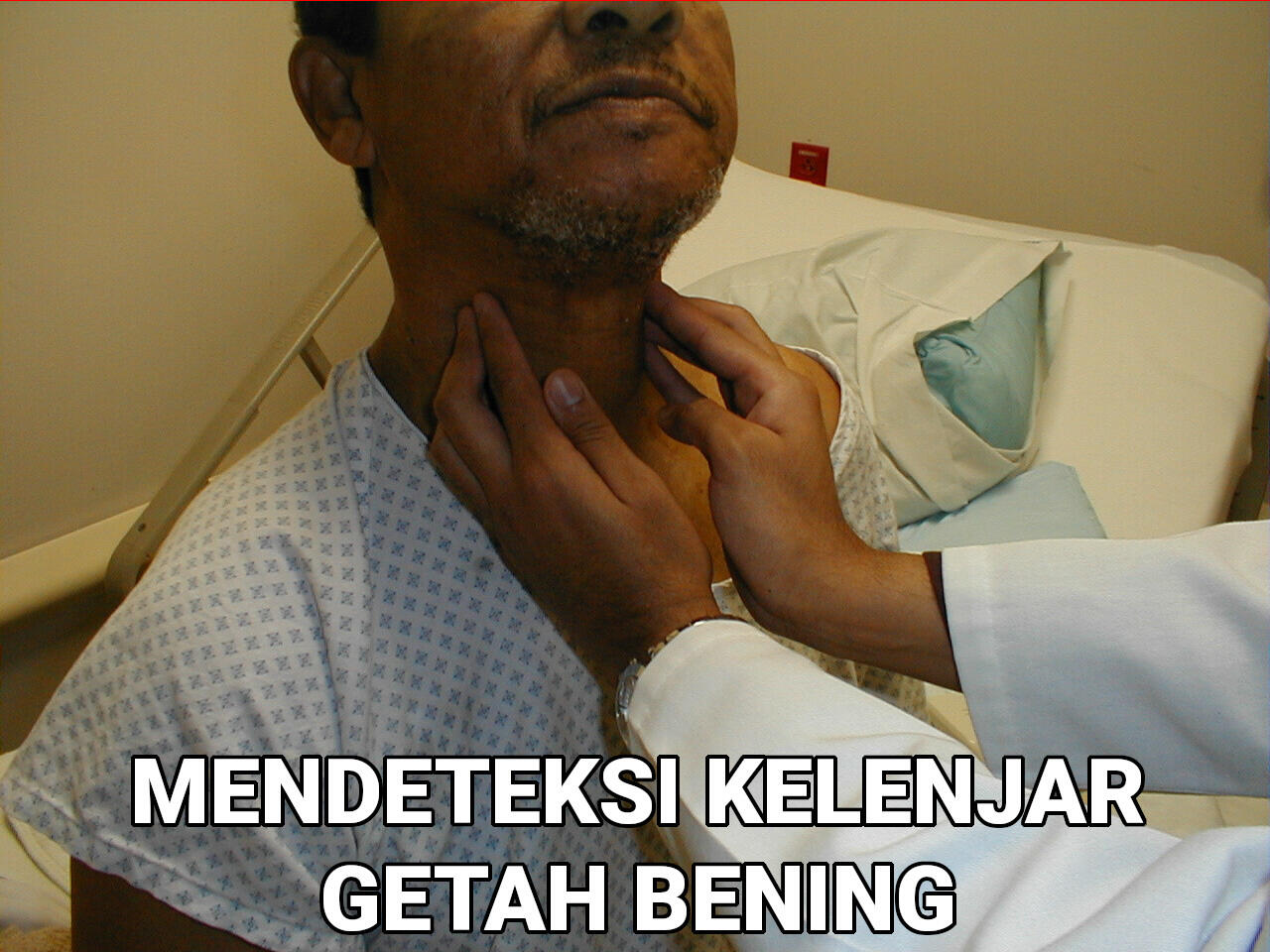 Cara Mendeteksi Benjolan Kelenjar Getah Bening Dengan Benar