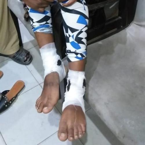 Kisah Bocah 12 tahun yang diculik, dirantai, dan dipaksa menikah dengan penculiknya