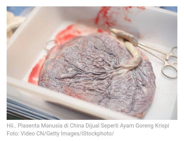 Di China, Plasenta Manusia Dijual Seperti Ayam Goreng