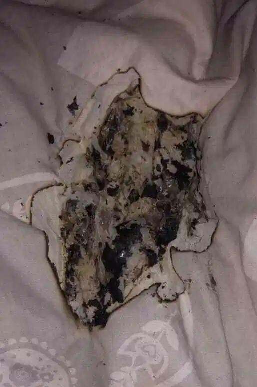 Apple Lakukan Investigasi Carger yang Terbakar, Yang melukai Wajah Gadis ini