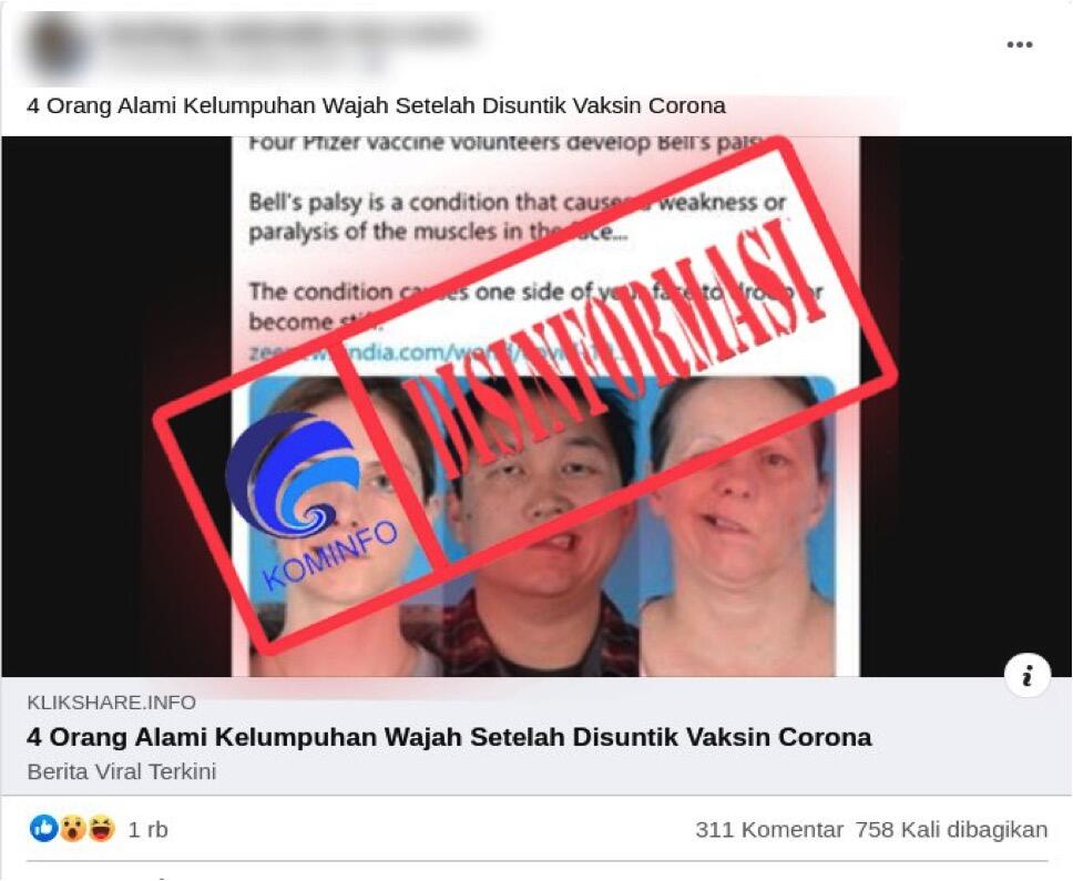Divaksin Kok Mengalami Lumpuh Di Wajah, Liat Lagi Yuk Fakta Sebenarnya