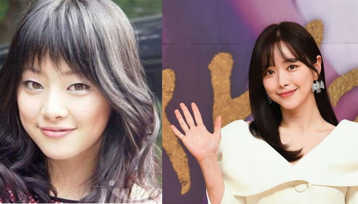Kisah Operasi Plastik Artis Hong Soo Ah, Jadi Lebih Lancar dalam Berkarir