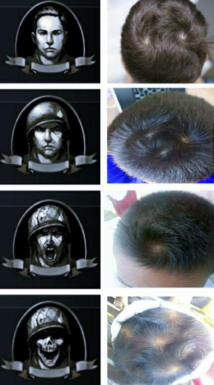 Dari Baik Hingga Buruk Berasal Dari Pusaran Rambut