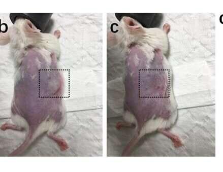 Alat Penyelamat Hidup Pasien Kanker, Dengan Metode Teknologi Microneedles